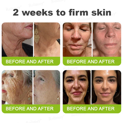 🌟👨‍⚕️Made and shipped from the UK 💫Rolimey® Botox & Vita-A Retinol Shot Wrinkle-Lift Tightening cream - Last Day Promotion 70% OFF