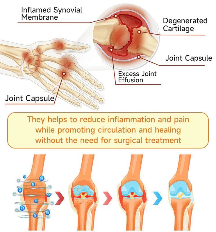 👨‍⚕️Official Shop:Rolimey® Bee Venom Pain Relief Bone Healing Cream 👨‍⚕️(Reduction of joint swelling, pain, stiffness, redness, heat, muscle soreness and joint fatigue)
