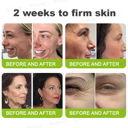 🌟👨‍⚕️Made and shipped from the UK 💫Rolimey® Botox & Vita-A Retinol Shot Wrinkle-Lift Tightening cream - Last Day Promotion 70% OFF