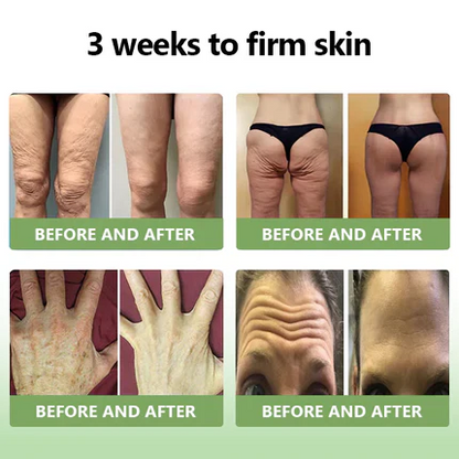 😍🔥GFOUK™  𝑳𝒖𝒙𝒖𝒓𝒊𝒐𝒖𝒔 𝑪𝒐𝒍𝒍𝒂𝒈𝒆𝒏 𝑭𝒊𝒓𝒎𝒊𝒏𝒈 𝑪𝒓𝒆𝒂𝒎(🔥70% Off for a Limited Time!)🎉