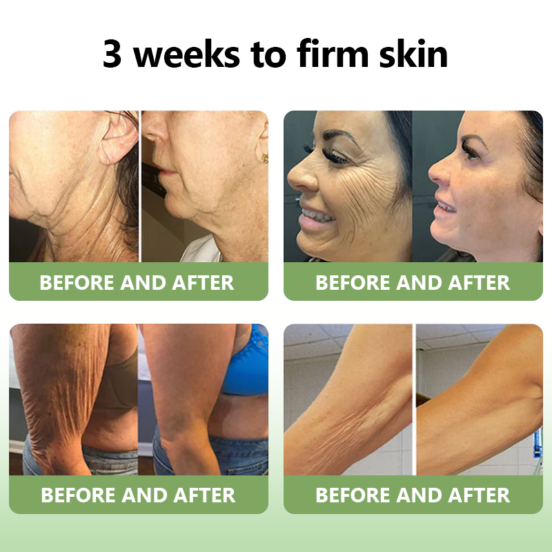 😍🔥GFOUK™  𝑳𝒖𝒙𝒖𝒓𝒊𝒐𝒖𝒔 𝑪𝒐𝒍𝒍𝒂𝒈𝒆𝒏 𝑭𝒊𝒓𝒎𝒊𝒏𝒈 𝑪𝒓𝒆𝒂𝒎(🔥70% Off for a Limited Time!)🎉