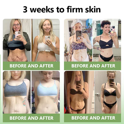 😍🔥GFOUK™  𝑳𝒖𝒙𝒖𝒓𝒊𝒐𝒖𝒔 𝑪𝒐𝒍𝒍𝒂𝒈𝒆𝒏 𝑭𝒊𝒓𝒎𝒊𝒏𝒈 𝑪𝒓𝒆𝒂𝒎(🔥70% Off for a Limited Time!)🎉
