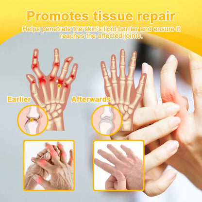 👨‍⚕️Official Shop:Rolimey® Bee Venom Pain Relief Bone Healing Cream 👨‍⚕️(Reduction of joint swelling, pain, stiffness, redness, heat, muscle soreness and joint fatigue)