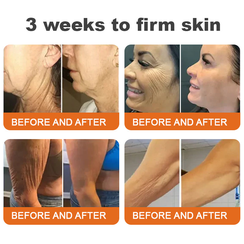 🫶Made and Shipped from UK🇬🇧Rolimey® Botox Bee Venom Firming Serum Stick(⏳LAST DAY 70% OFF)✨