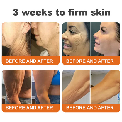 🫶Made and Shipped from UK🇬🇧Rolimey® Botox Bee Venom Firming Serum Stick(⏳LAST DAY 70% OFF)✨