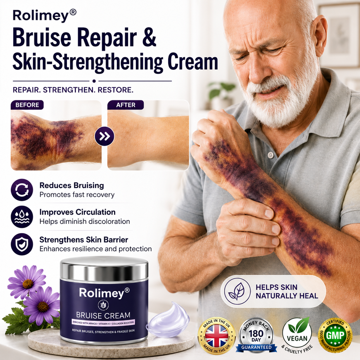 💥Over 100,000 units sold💕 - Rolimey® cream to repair bruises and strengthen the skin