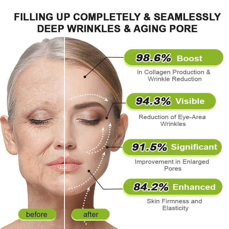 🌟👨‍⚕️Made and shipped from the UK 💫Rolimey® Botox & Vita-A Retinol Shot Wrinkle-Lift Tightening cream - Last Day Promotion 70% OFF