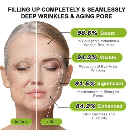 🌟👨‍⚕️Made and shipped from the UK 💫Rolimey® Botox & Vita-A Retinol Shot Wrinkle-Lift Tightening cream - Last Day Promotion 70% OFF