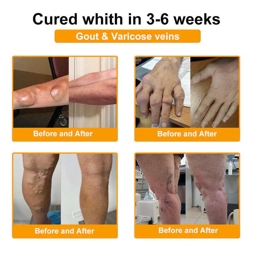👨‍⚕️Official Shop:Rolimey® Bee Venom Pain Relief Bone Healing Cream 👨‍⚕️(Reduction of joint swelling, pain, stiffness, redness, heat, muscle soreness and joint fatigue)