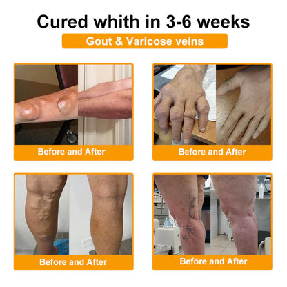 👨‍⚕️Official Shop:Rolimey® Bee Venom Pain Relief Bone Healing Cream 👨‍⚕️(Reduction of joint swelling, pain, stiffness, redness, heat, muscle soreness and joint fatigue)