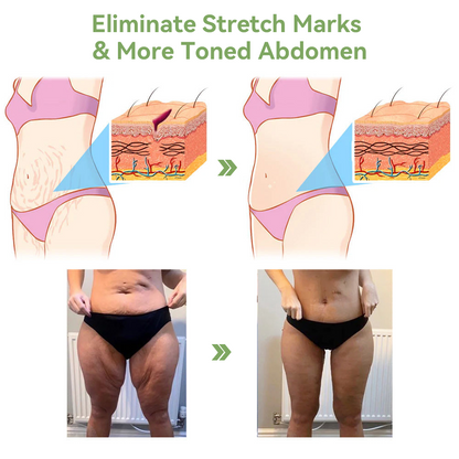 😍🔥GFOUK™  𝑳𝒖𝒙𝒖𝒓𝒊𝒐𝒖𝒔 𝑪𝒐𝒍𝒍𝒂𝒈𝒆𝒏 𝑭𝒊𝒓𝒎𝒊𝒏𝒈 𝑪𝒓𝒆𝒂𝒎(🔥70% Off for a Limited Time!)🎉