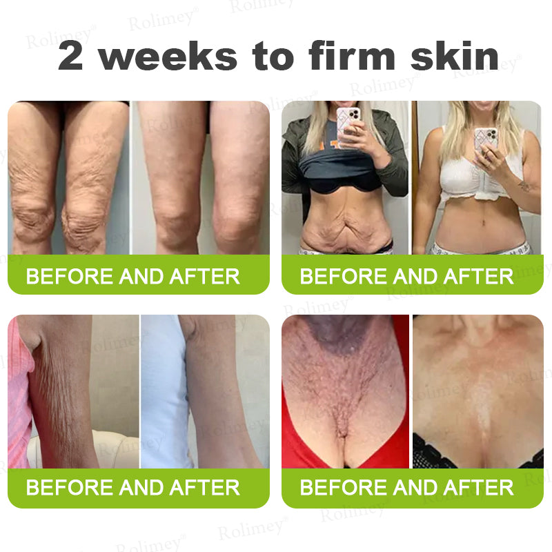 🌟👨‍⚕️Made and shipped from the UK 💫Rolimey® Botox & Vita-A Retinol Shot Wrinkle-Lift Tightening cream - Last Day Promotion 70% OFF