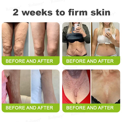 🌟👨‍⚕️Made and shipped from the UK 💫Rolimey® Botox & Vita-A Retinol Shot Wrinkle-Lift Tightening cream - Last Day Promotion 70% OFF
