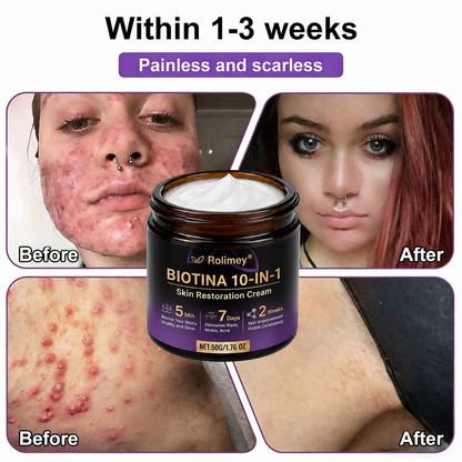Product shipped from the UK ✨ Rolimey® Biotin 10-in-1 Skin Restoration Cream 🍀