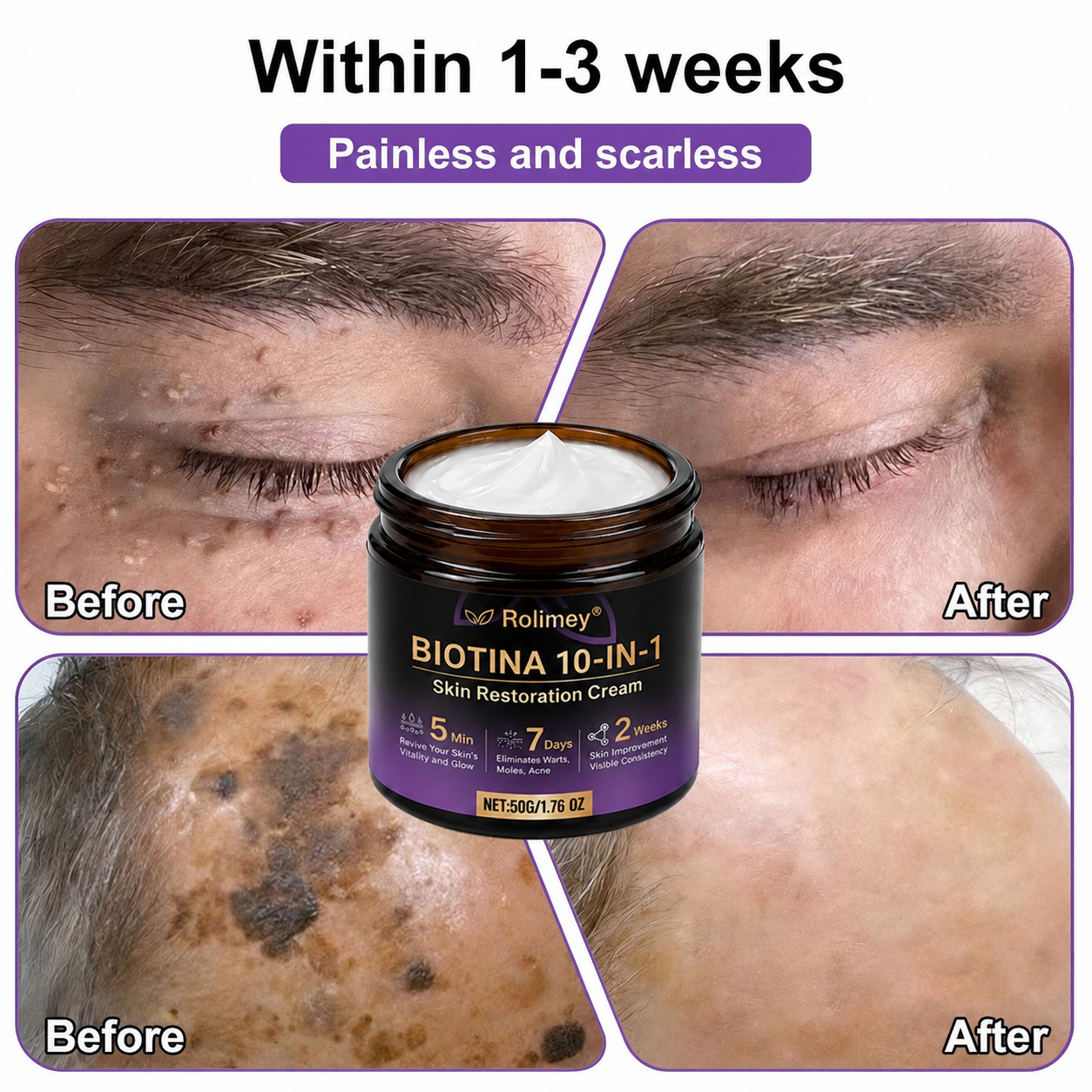 Product shipped from the UK ✨ Rolimey® Biotin 10-in-1 Skin Restoration Cream 🍀