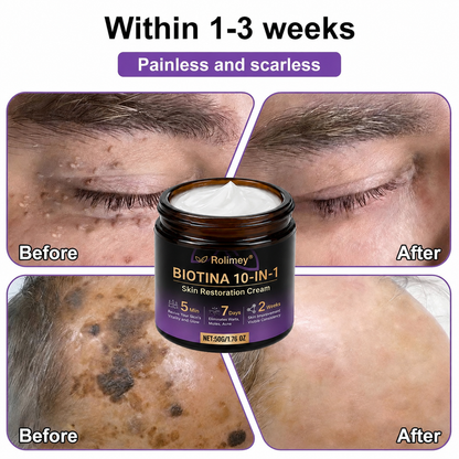 Product shipped from the UK ✨ Rolimey® Biotin 10-in-1 Skin Restoration Cream 🍀