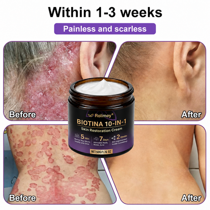 Product shipped from the UK ✨ Rolimey® Biotin 10-in-1 Skin Restoration Cream 🍀