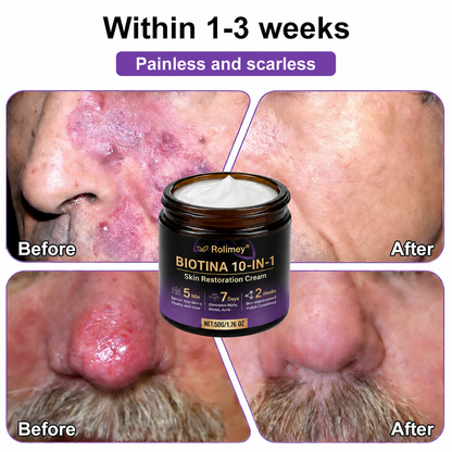 Product shipped from the UK ✨ Rolimey® Biotin 10-in-1 Skin Restoration Cream 🍀