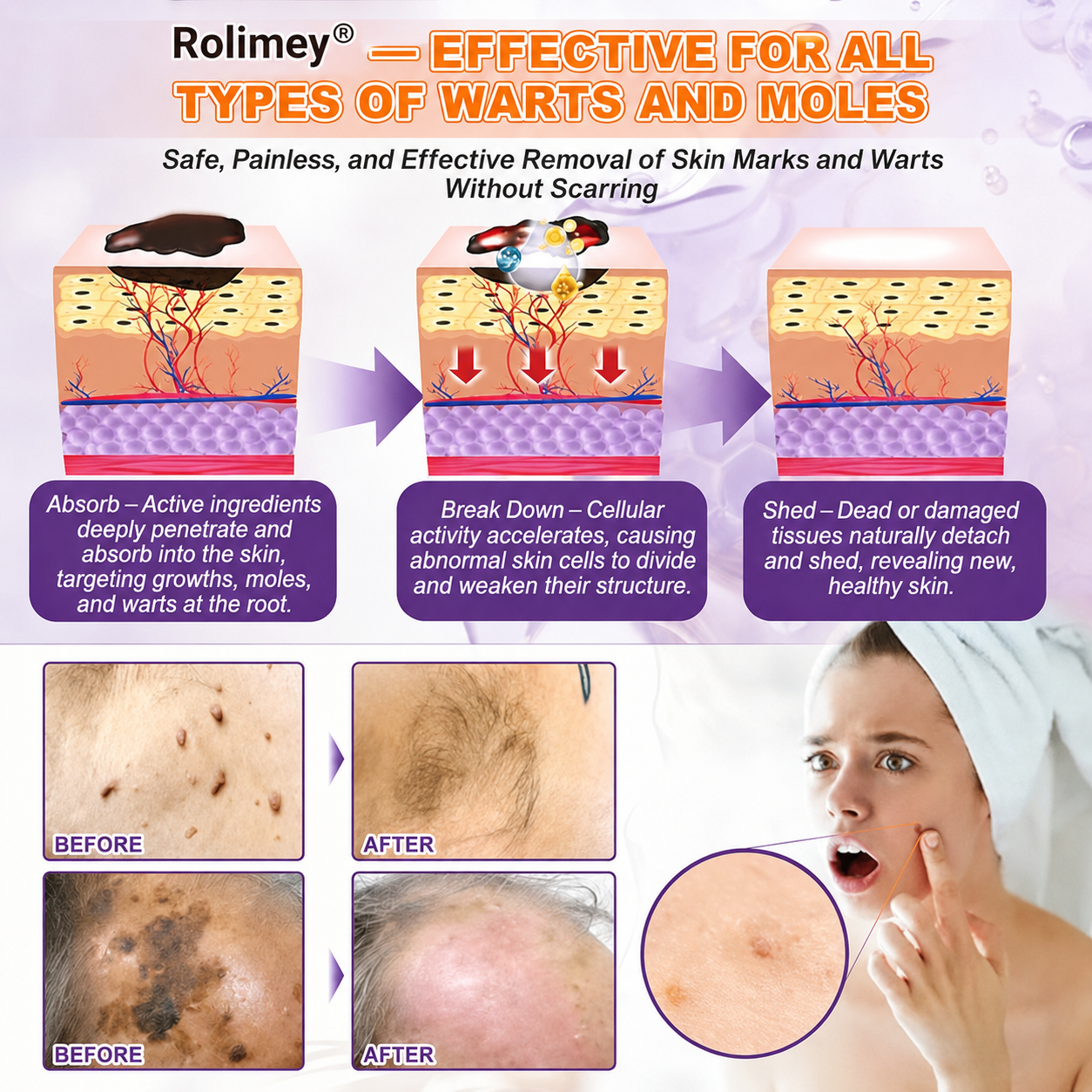Product shipped from the UK ✨ Rolimey® Biotin 10-in-1 Skin Restoration Cream 🍀