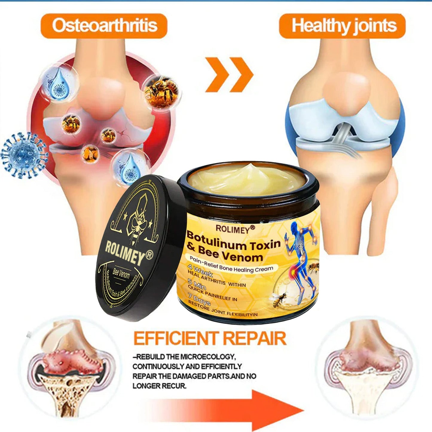 👨‍⚕️Official Shop:Rolimey® Bee Venom Pain Relief Bone Healing Cream 👨‍⚕️(Reduction of joint swelling, pain, stiffness, redness, heat, muscle soreness and joint fatigue)
