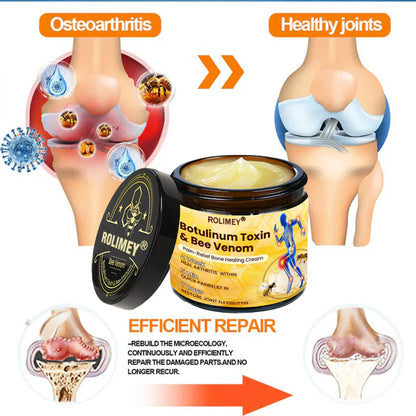 👨‍⚕️Official Shop:Rolimey® Bee Venom Pain Relief Bone Healing Cream 👨‍⚕️(Reduction of joint swelling, pain, stiffness, redness, heat, muscle soreness and joint fatigue)