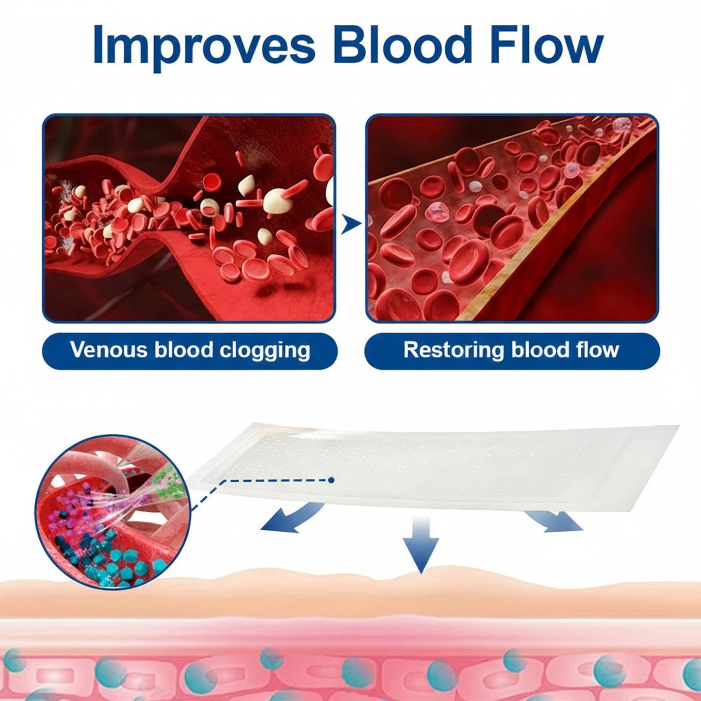 🇬🇧👨‍⚕️🔥GFOUK® VeinEase Microneedle Care Patch⚡Instant Relief, Long-Term Results