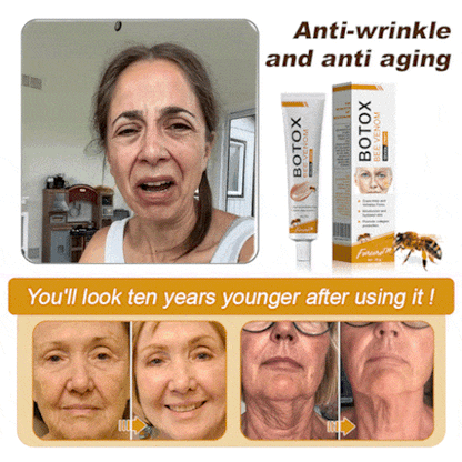 😍😍Made and Shipped from UK✅) Furzero™ Botox Bee Venom Wrinkle Removal Cream- LAST DAY 70% OFF