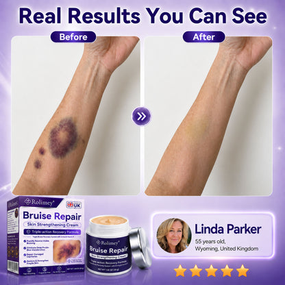 👨‍⚕️Over 100,000 units sold💕 - Rolimey® cream to repair bruises and strengthen the skin