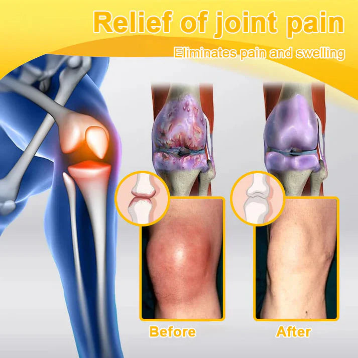 👨‍⚕️Official Shop:Rolimey® Bee Venom Pain Relief Bone Healing Cream 👨‍⚕️(Reduction of joint swelling, pain, stiffness, redness, heat, muscle soreness and joint fatigue)
