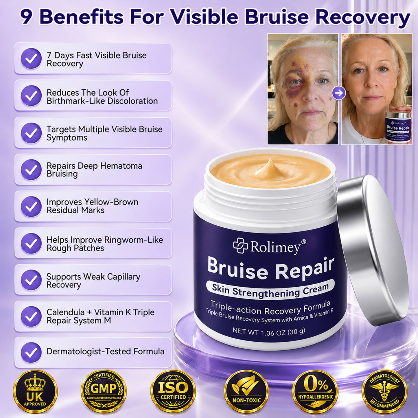 👨‍⚕️Over 100,000 units sold💕 - Rolimey® cream to repair bruises and strengthen the skin
