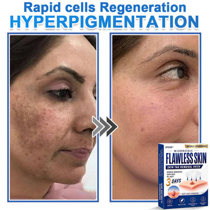 ⚡GFOUK® 2026 Newly Upgraded 2-in-1 Microneedle Hydrocolloid Patches | Removes Raised Moles, Acne, Flat Warts, and Skin Tags | Improves Wrinkles, Scars, and Blemishes | Invisible Acne Patches for Face & Body