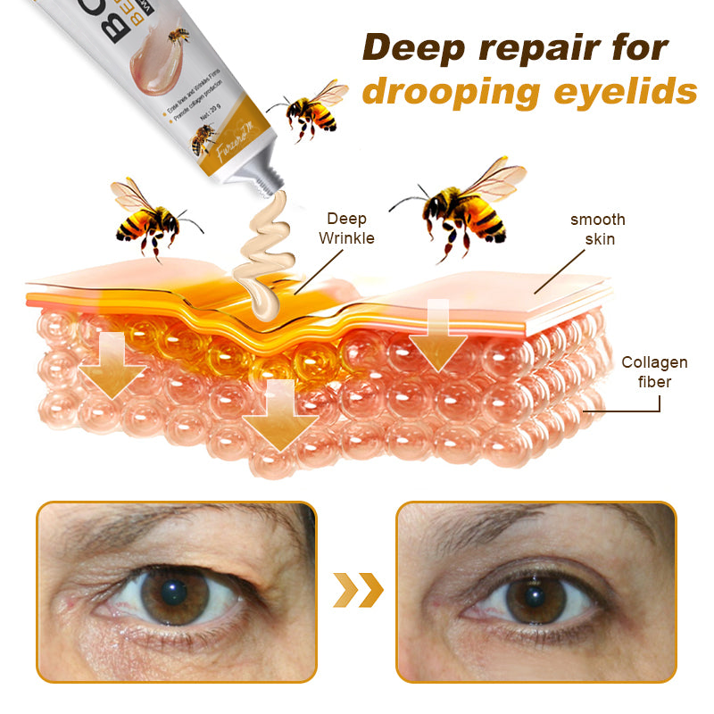 💪Made and Shipped from UK✅) Furzero™ Botox Bee Venom Wrinkle Removal Cream- LAST DAY 70% OFF