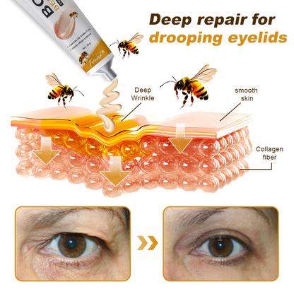 💪Made and Shipped from UK✅) Furzero™ Botox Bee Venom Wrinkle Removal Cream- LAST DAY 70% OFF
