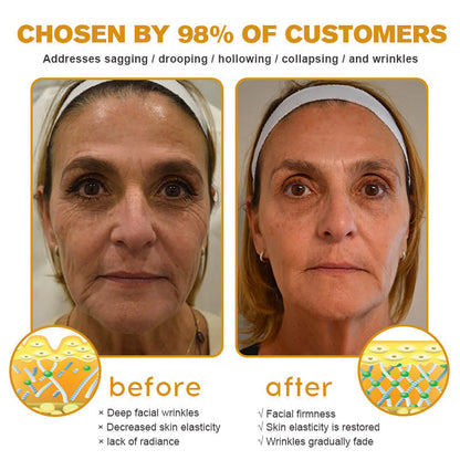 👩‍⚕️Made and Shipped from UK✅) Furzero™ Botox Bee Venom Wrinkle Removal Cream- LAST DAY 70% OFF