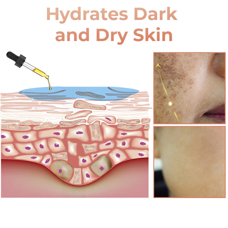 🔥 “My Holy Grail for Dark Spots” – GFOUK® Niacinamide Brightening Serum