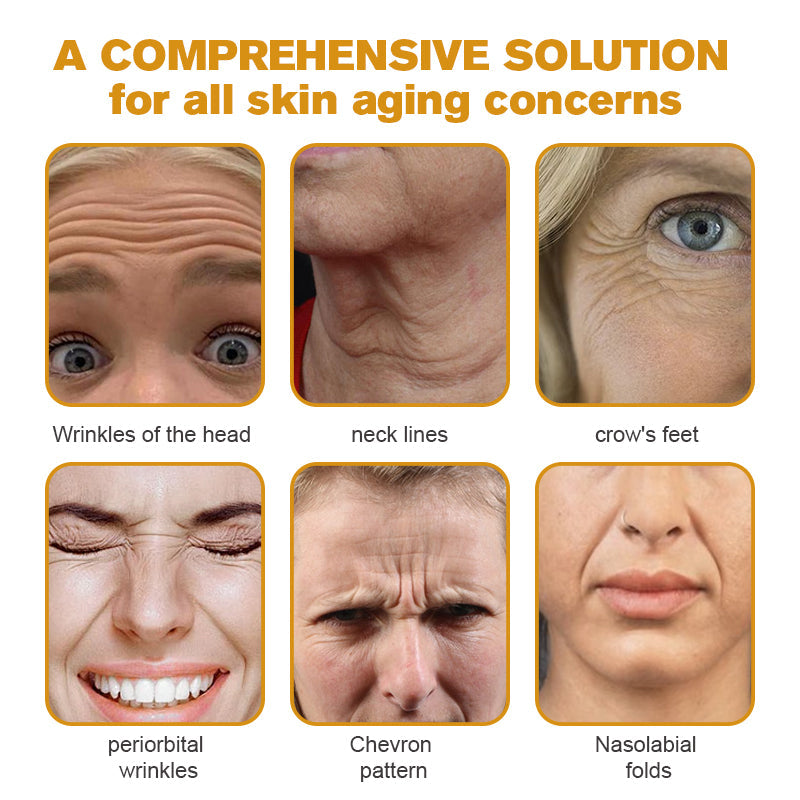 💪Made and Shipped from UK✅) Furzero™ Botox Bee Venom Wrinkle Removal Cream- LAST DAY 70% OFF