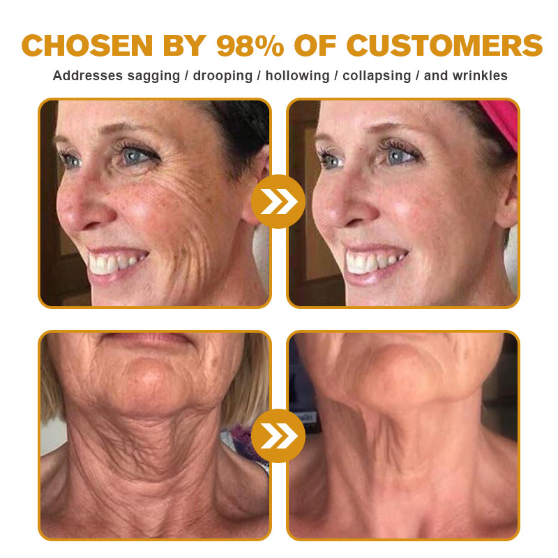 💪Made and Shipped from UK✅) Furzero™ Botox Bee Venom Wrinkle Removal Cream- LAST DAY 70% OFF