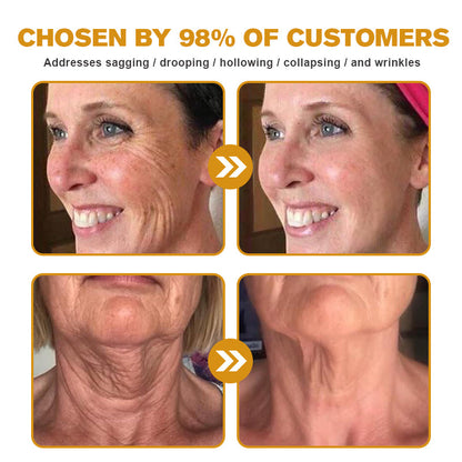 💪Made and Shipped from UK✅) Furzero™ Botox Bee Venom Wrinkle Removal Cream- LAST DAY 70% OFF